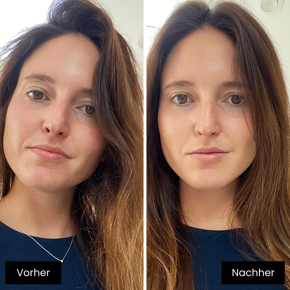 Airelle Pro